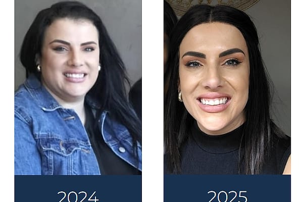Thelma Olckers, before and after her bariatric surgery journey, dated 2024 and 2025.